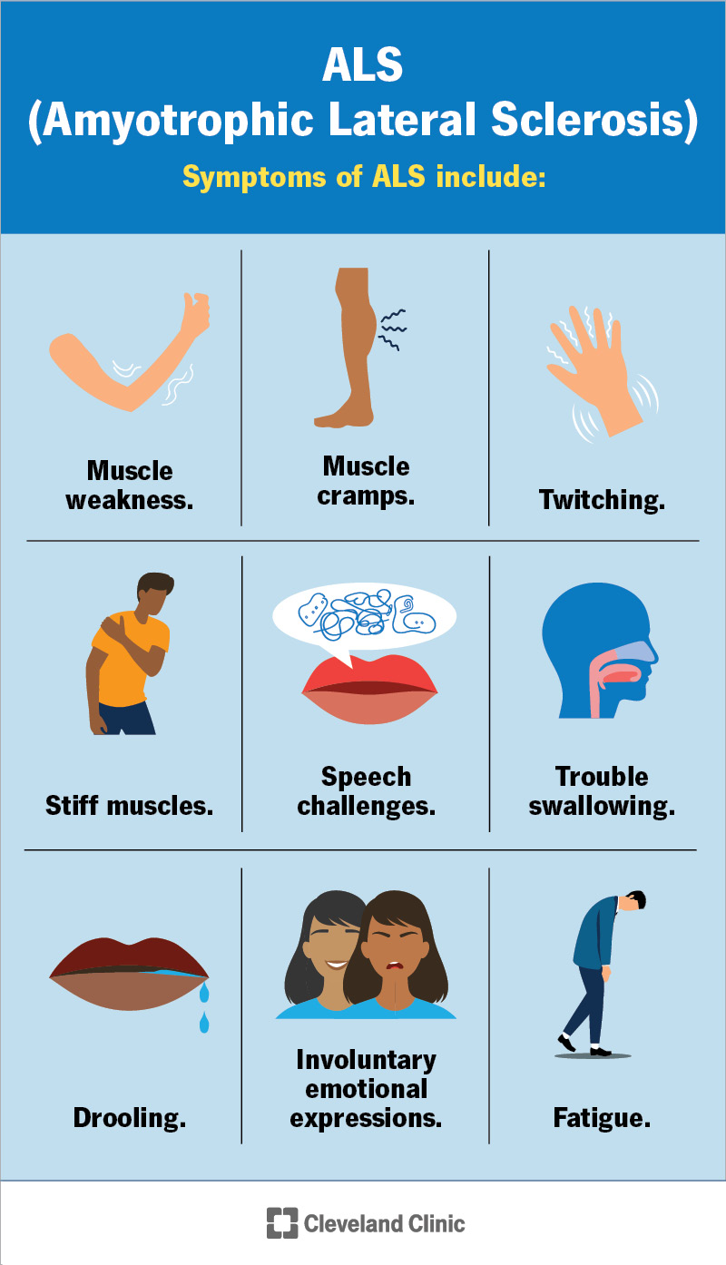 Infographic of symptoms of Amyotrophic Lateral Sclerosis (ALS)