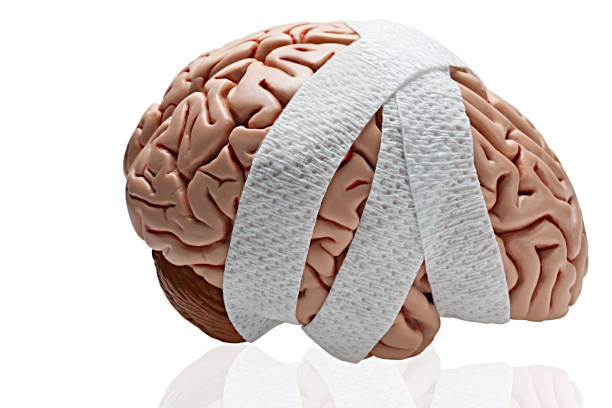 Gauze wrapped around a brain to symbolize a Traumatic Brain Injury.