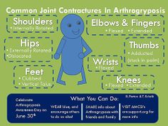 Arthrogryposis